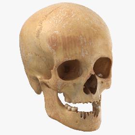 3D Real Human Female Skull With Jaw Damaged 02 model